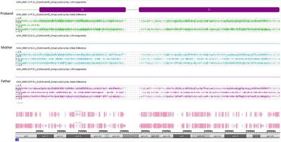 Co-occurrence of Beckwith-Wiedemann syndrome and pseudohypoparathyroidism type 1B: coincidence or common molecular mechanism?